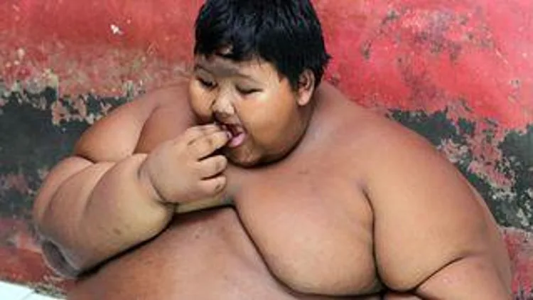 רץ ברשת – "הילד השמן בעולם" מתחיל דיאטה כדי להציל את חייו | חדשות 13