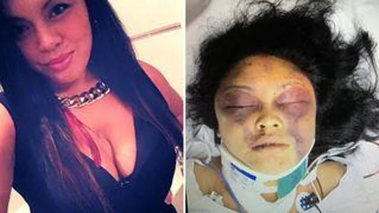 רץ ברשת – הסלפי החושפני שכמעט עלה לאישה הזאת בחיים | חדשות 13