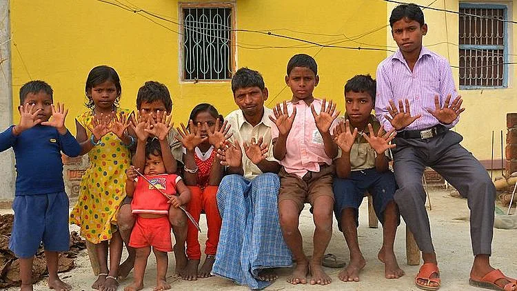 600 אצבעות לי יש: משפחה אחת, 25 אנשים ו-600 אצבעות