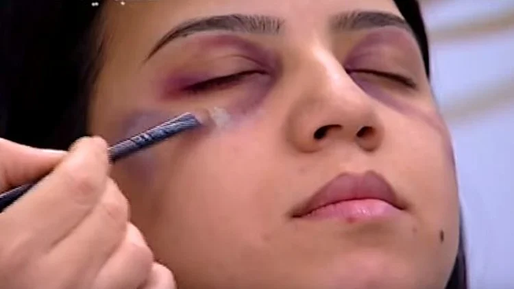 אישה מוכה? כך תסתירי את החבלות בפנייך