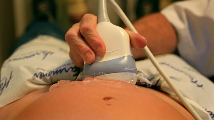 צעירה בת 27 ביצעה בדיקת מי שפיר: העובר מת | חדשות 13