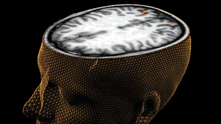 סוף לזכרונות הרעים? (אילוסטרציה