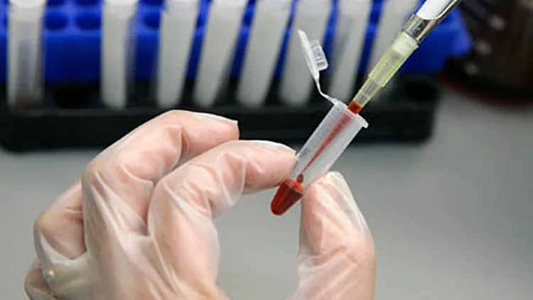 חולת סוכרת נעורים מתה בשנתה | חדשות 13