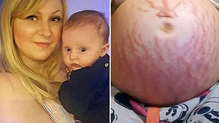 "התינוק שלי ניסה להרוג אותי"