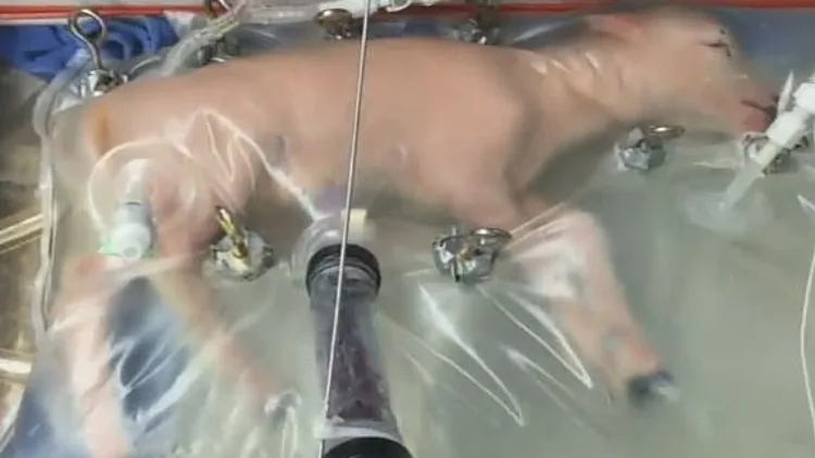 פריצת דרך: פגים יחיו ברחם מלאכותי | חדשות 13