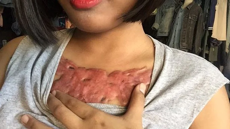 לפני שאתם מתקעקעים – כדאי שתראו מה קרה לאישה הזאת | חדשות 13