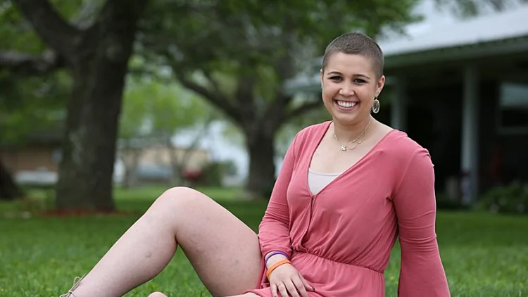 מלכת היופי השתילה קרסול במקום ברך לאחר שרגלה נכרתה