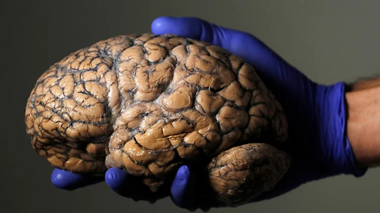 צפו: הצצה למוח האנושי | חדשות 13