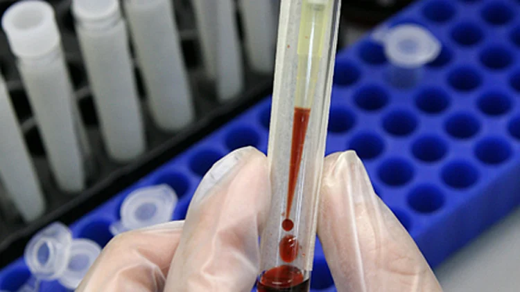 "ניהלתי את האקזיט כמו ב-669" | חדשות 13