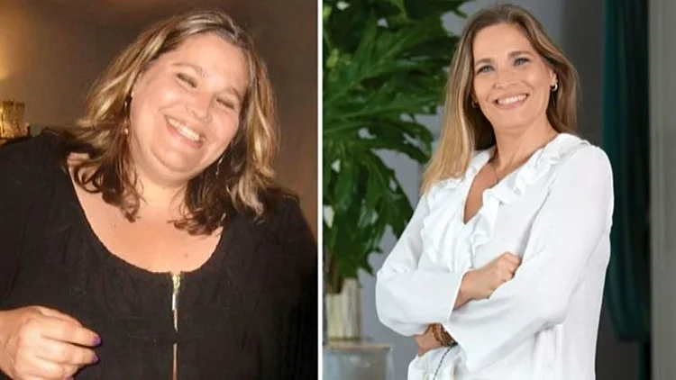 קיצור קיבה: מפגש מרגש בין אלונה לרופא שהציל את חייה