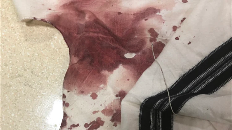 הציצית של אברהם גופין שהותקף בברוקלין