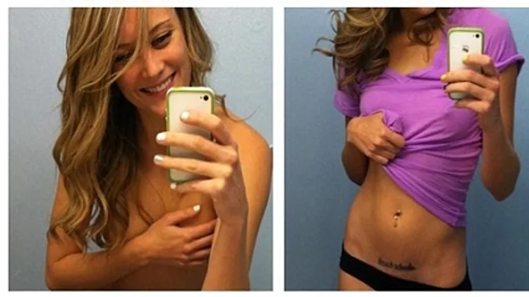 קרלי מק’קיני והתמונות החושפניות