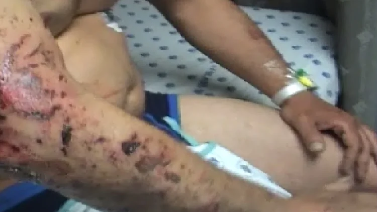 צלף במיל', שומר של עבריין בכיר: המאבטח שנפצע בירי בגבעתיים מדבר מביה"ח | חדשות 13