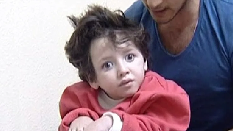 הילדה אדל ביטון, שנפגעה בעקבות יידוי אבנים לעבר רכב משפחתה