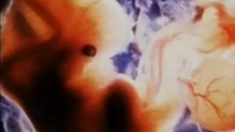 סרטון של אגודת אפרת למניעת הפלות