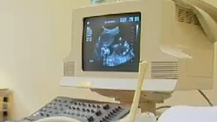 אולטרה סאונד