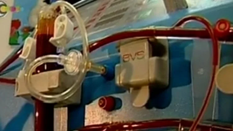 מכונת דיאליזה בבית חולים