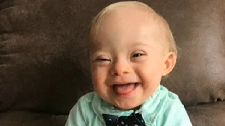 לוקאס וורן, תינוק עם תסמונת דאון שנבחר לייצג את חברת "גרבר"