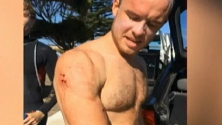 יצא כריש: הגולש הבריטי שניצל ממלתעות הטורף | חדשות 13