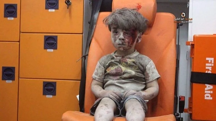 ילד סורי שנפגע בהפצצות בחלב