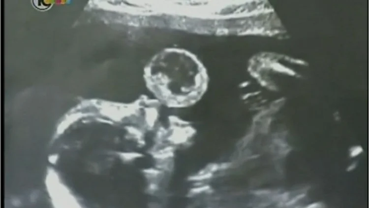 חיים בריא: 09.09.15