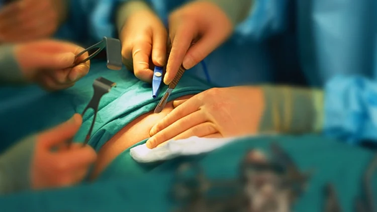 אילוסטרציה