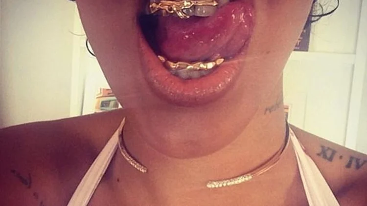 תכשיט שיניים