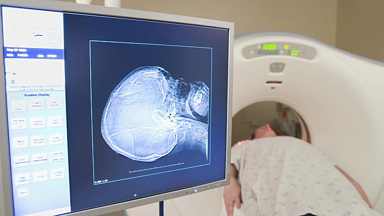 סריקת אם אר איי - MRI