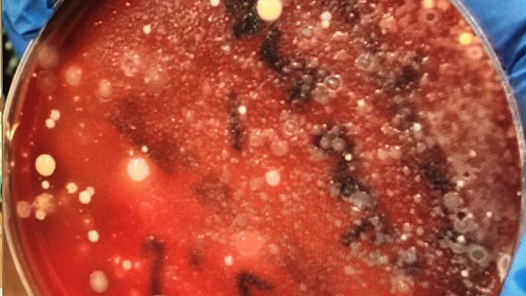 החיידקים שנמצאו בבדיקת מעבדה על מסך טלפון סלולרי