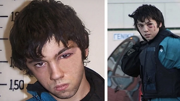 סימני אלימות נעלמו בפוטושופ