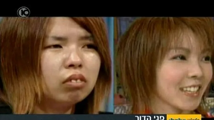 פנים למערב: הסינים מטורפים על ניתוחים פלסטיים