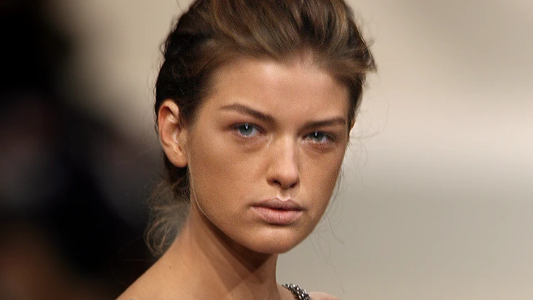 דוגמנית אנורקסית