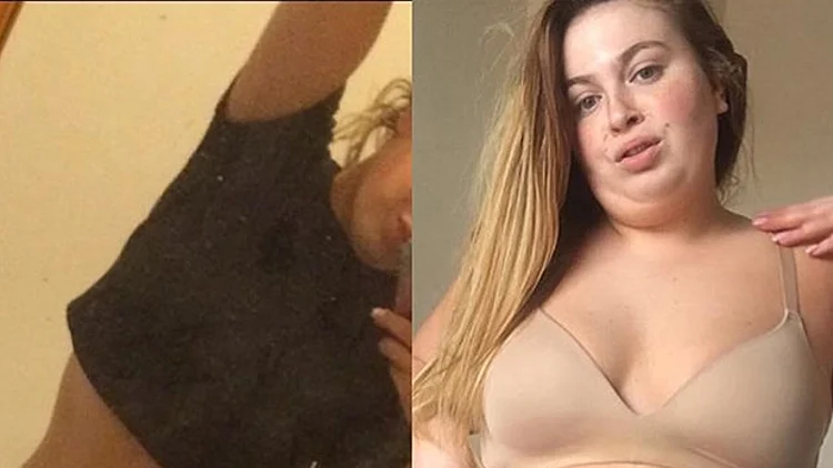 שמנה וטוב לה: "אוהבת את הצלוליטיס שלי"