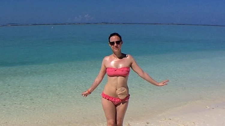 "אני לא יודעת עוד כמה זמן נותר לי, אל תתעלמו מהתסמינים"