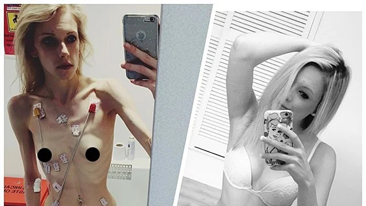 הסוד שלה לאריכות ימים - ביצים!