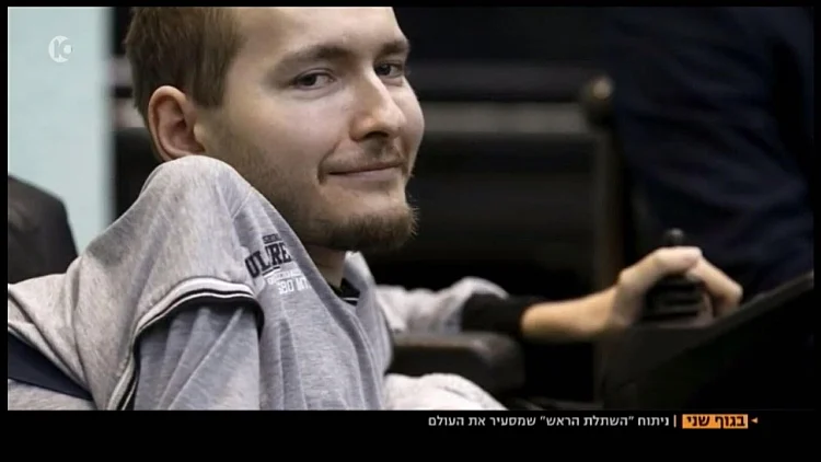 האם ניתן לחבר ראש לגוף?