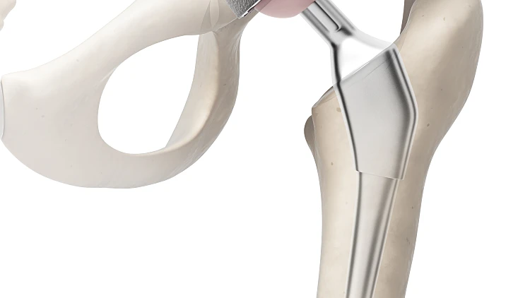 הדמיה מפרק ירך