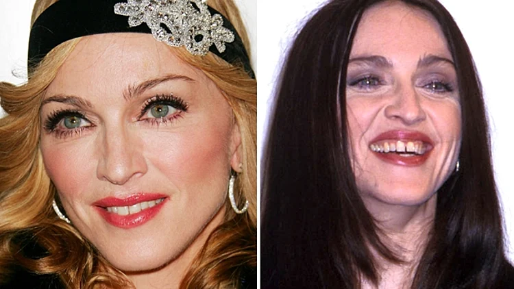 8 דברים שכדאי לדעת על השתלות שיניים