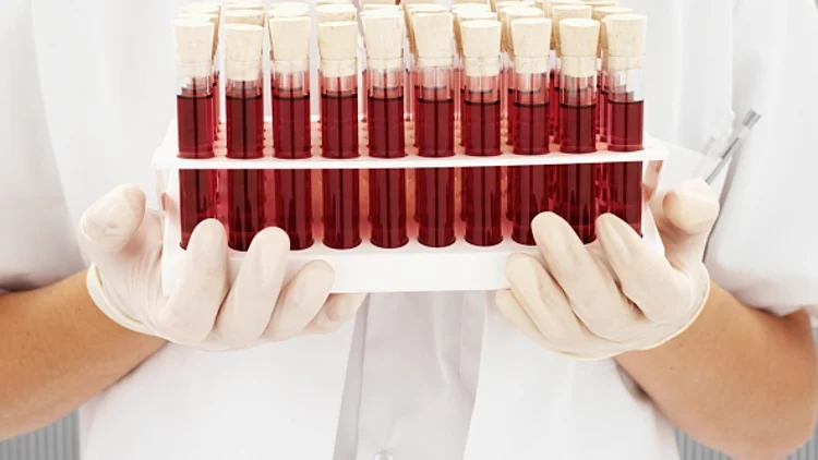 בדיקת דם, סוג דם