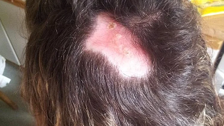 דורון מטלון