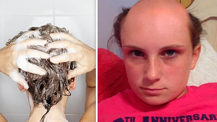 במה היא חפפה שהשיער שלה נשר?