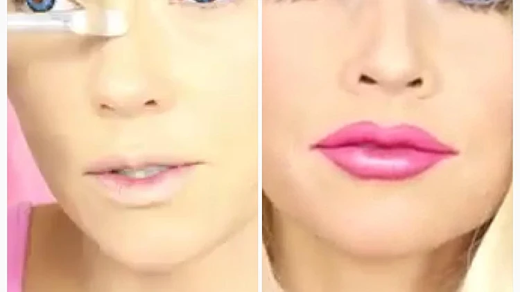 לפניואחרי: ברבי ברגע