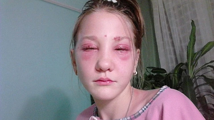 זהירות, טיפולים אסתטיים