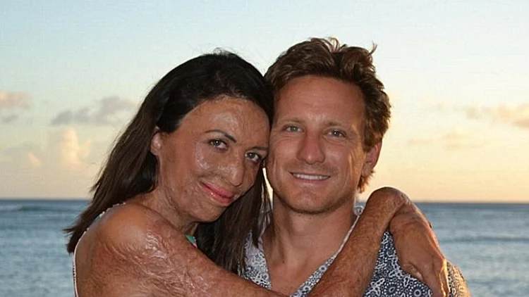 מוכיח שהאופי עולה על היופי