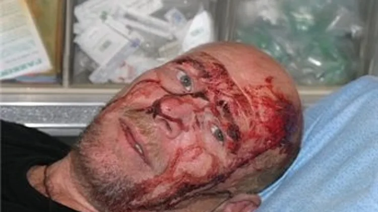 מוהיב אל-ברגותי, צלם העיתון אל חייאת אל ג'דידה שהותקף ע"י חיילי צה"ל