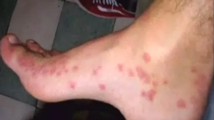 פישפשי מיטה