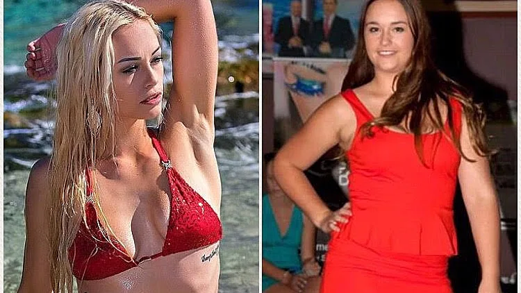 לפני ואחרי: השילה 40 קילוגרמים והפכה לדוגמנית