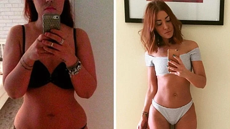 רצתה להיות כלה רזה