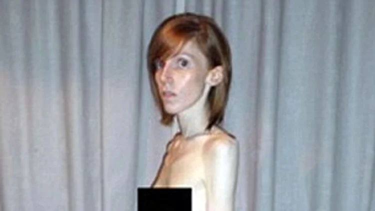 שוק! חיה על 10 קלוריות ביום