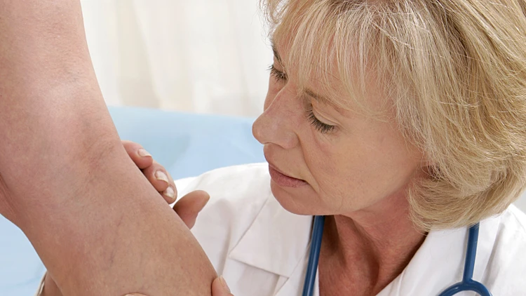 ורידים ברגליים